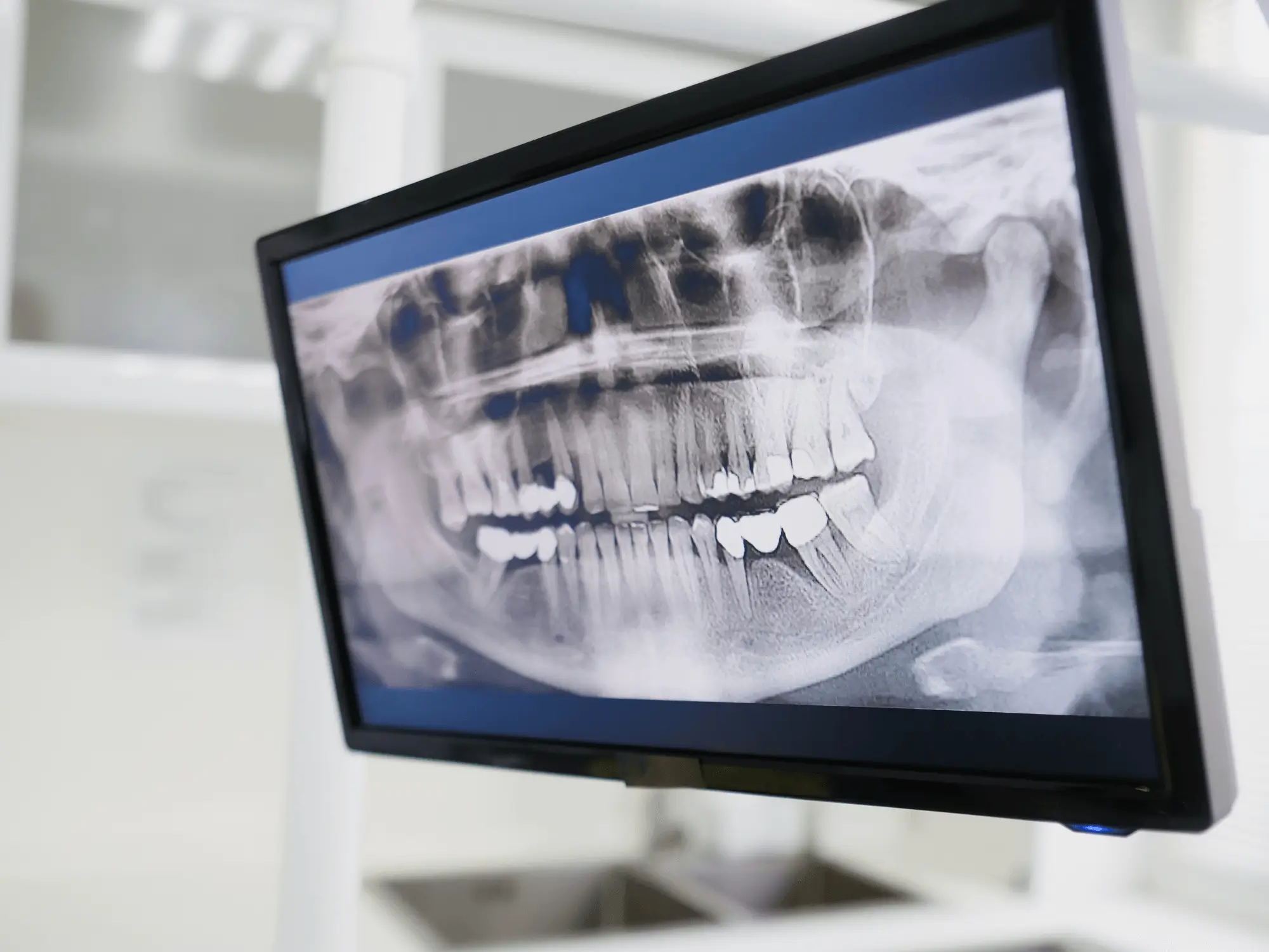 Imagistică Dentară (2)